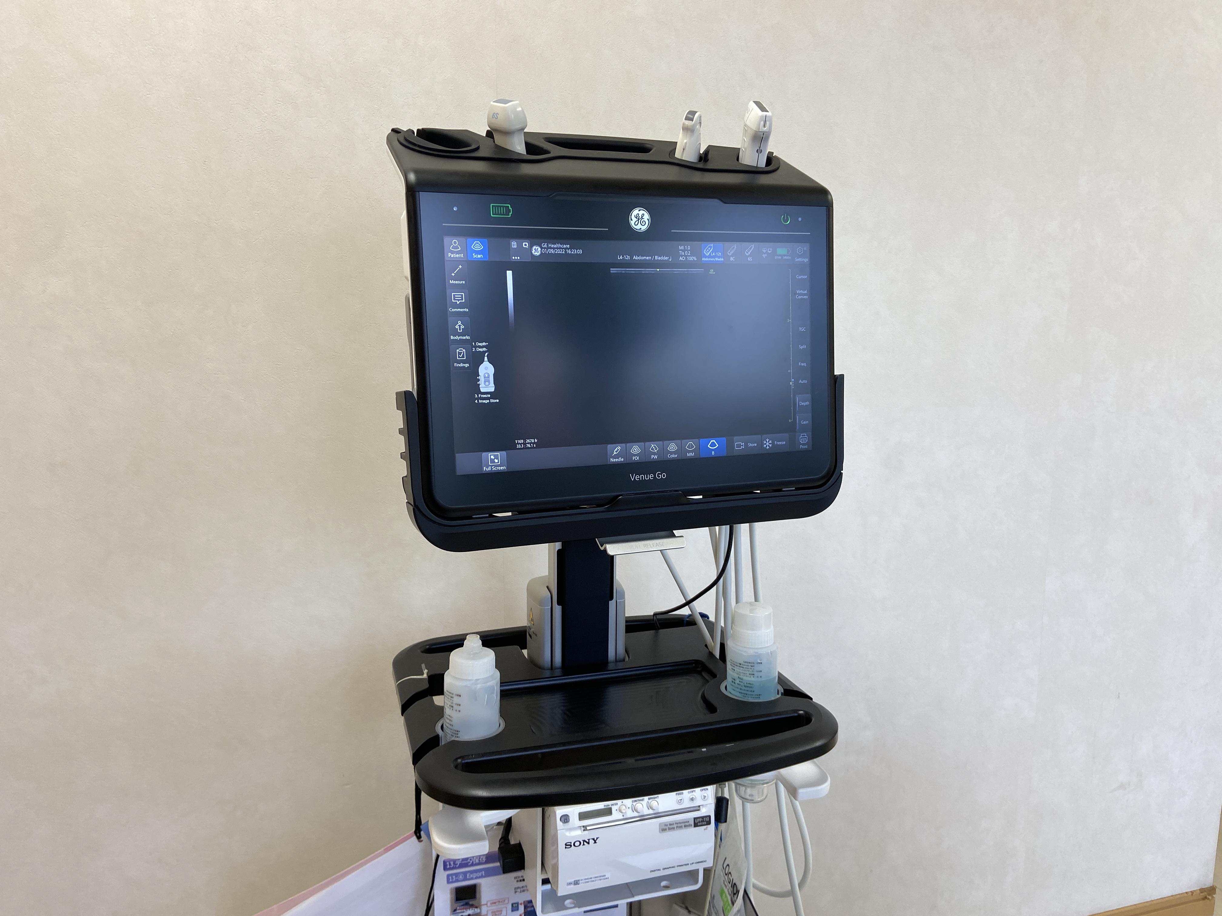 CT以外にも超音波検査も画像診断の1つのツールとして使います